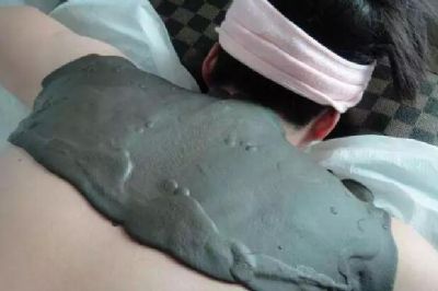 泥灸敷出水珠是怎么回事，好不好