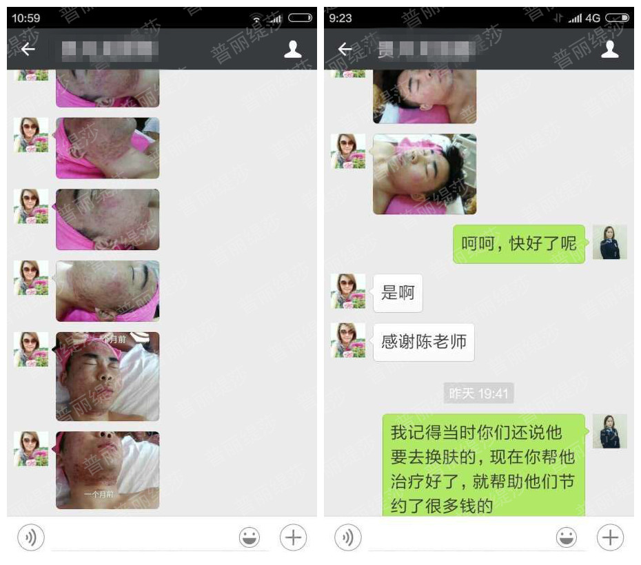 美容院祛痘神器：绿茶清爽系列造就祛痘奇迹