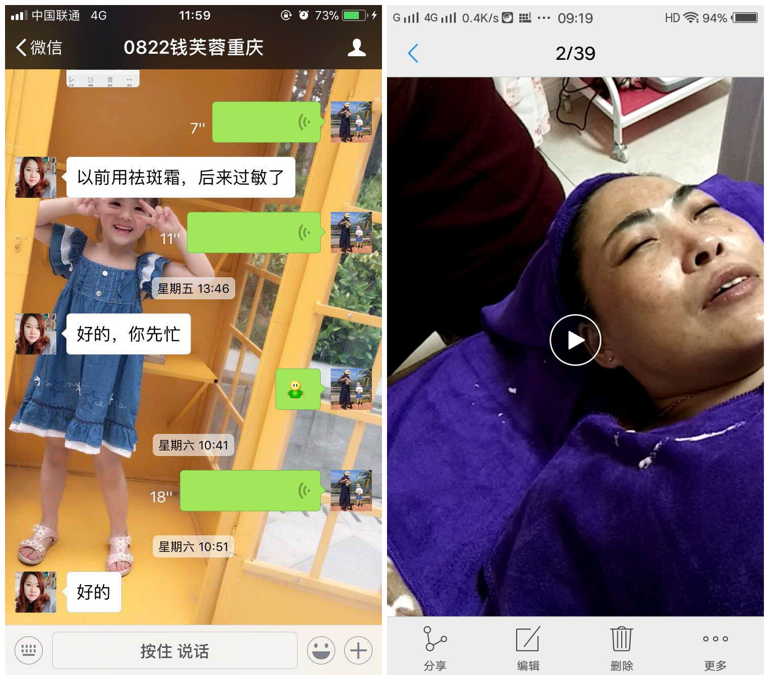 香蕉视频网页版 “雪肌晶纯系列”   4个月拯救色斑激素脸